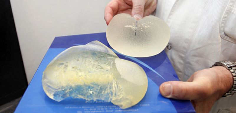 La Audiencia no ve responsabilidad del Estado por la implantación de prótesis mamarias PIP