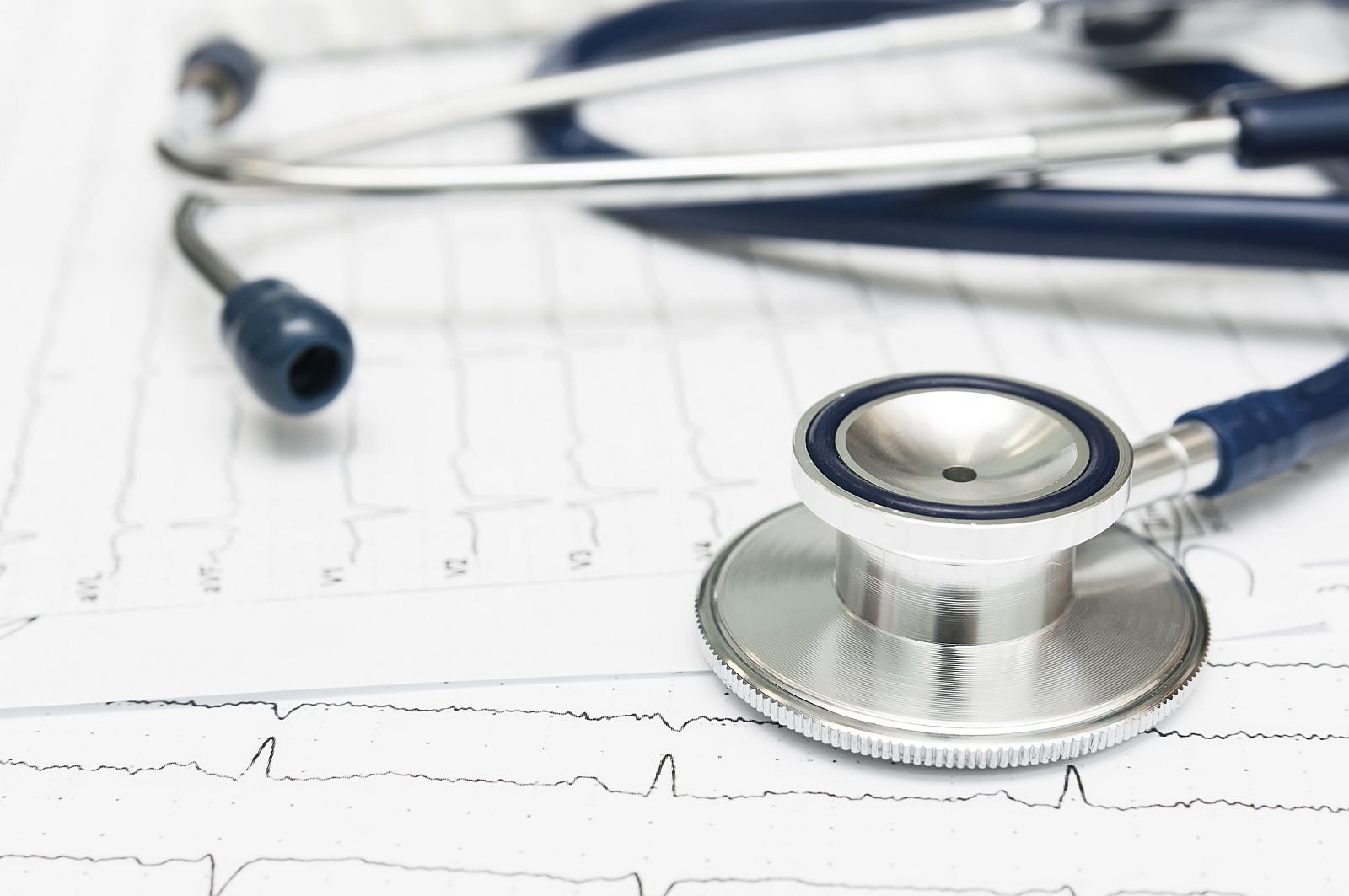 Un estetoscopio sobre un electrocardiograma.