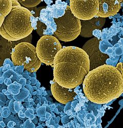 Crean un biosensor de grafeno para detectar la bacteria estafilococo dorado