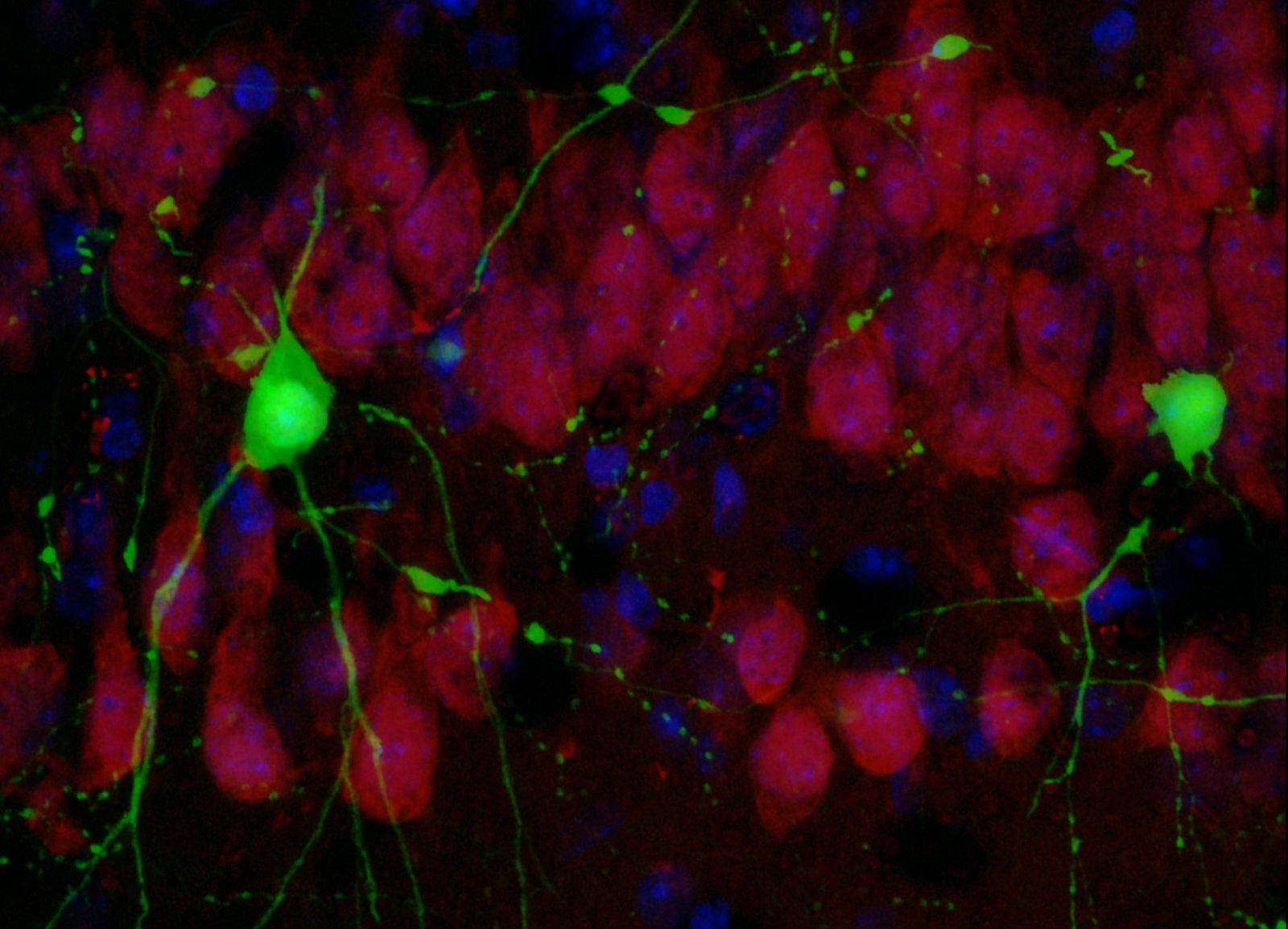 Detección de la poteïna Crtc1 en neuronas del hipocampo de ratón. La proteína destaca en color verde.