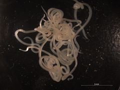 Caracterizan la potencialidad alergénica de ciertas especies de Anisakis