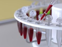 Avanzan en la detección temprana del alzheimer mediante un análisis de sangre