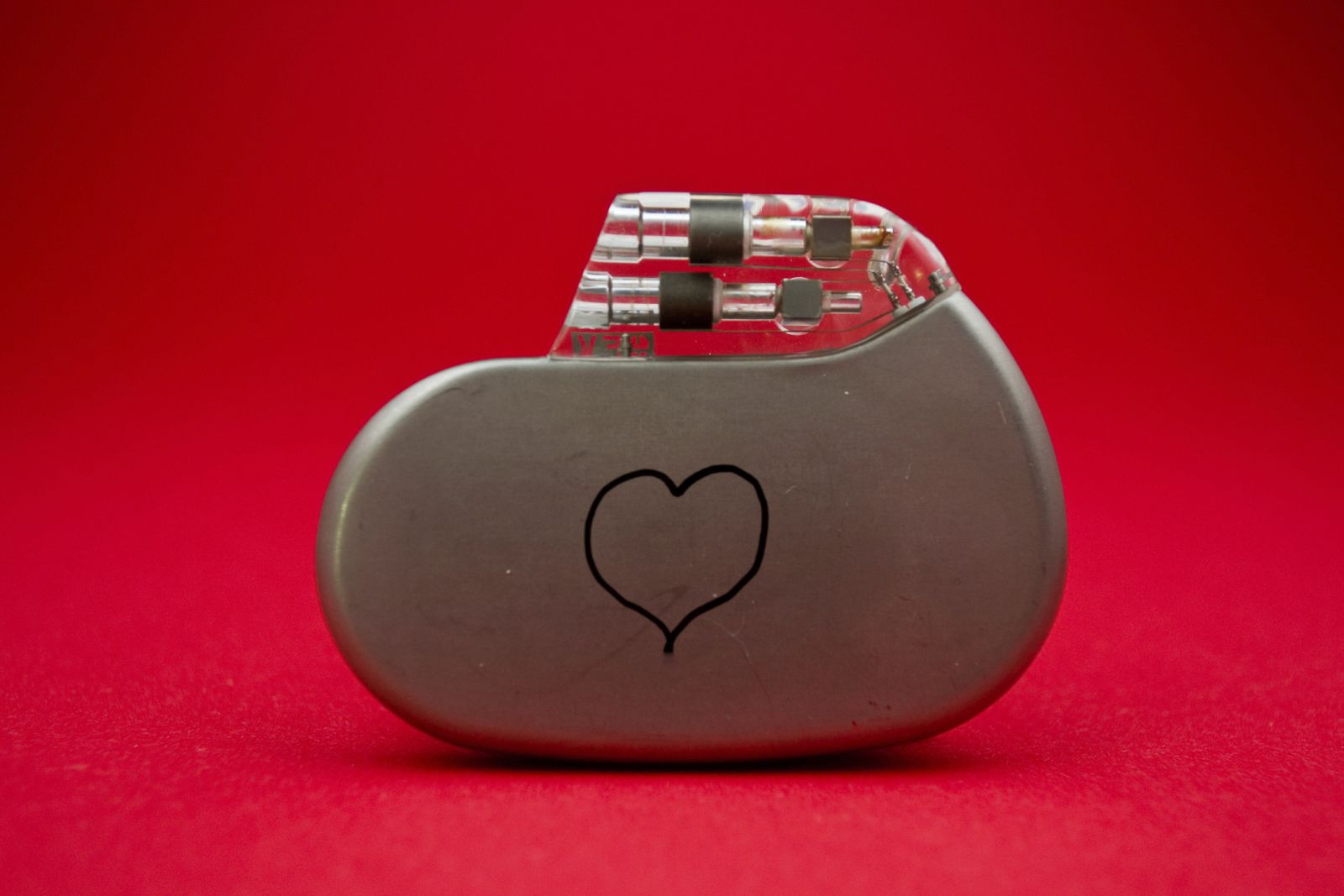 Marcapasos tradicional.