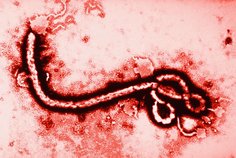 Qué es el ébola, cómo se transmite y por qué es tan mortal