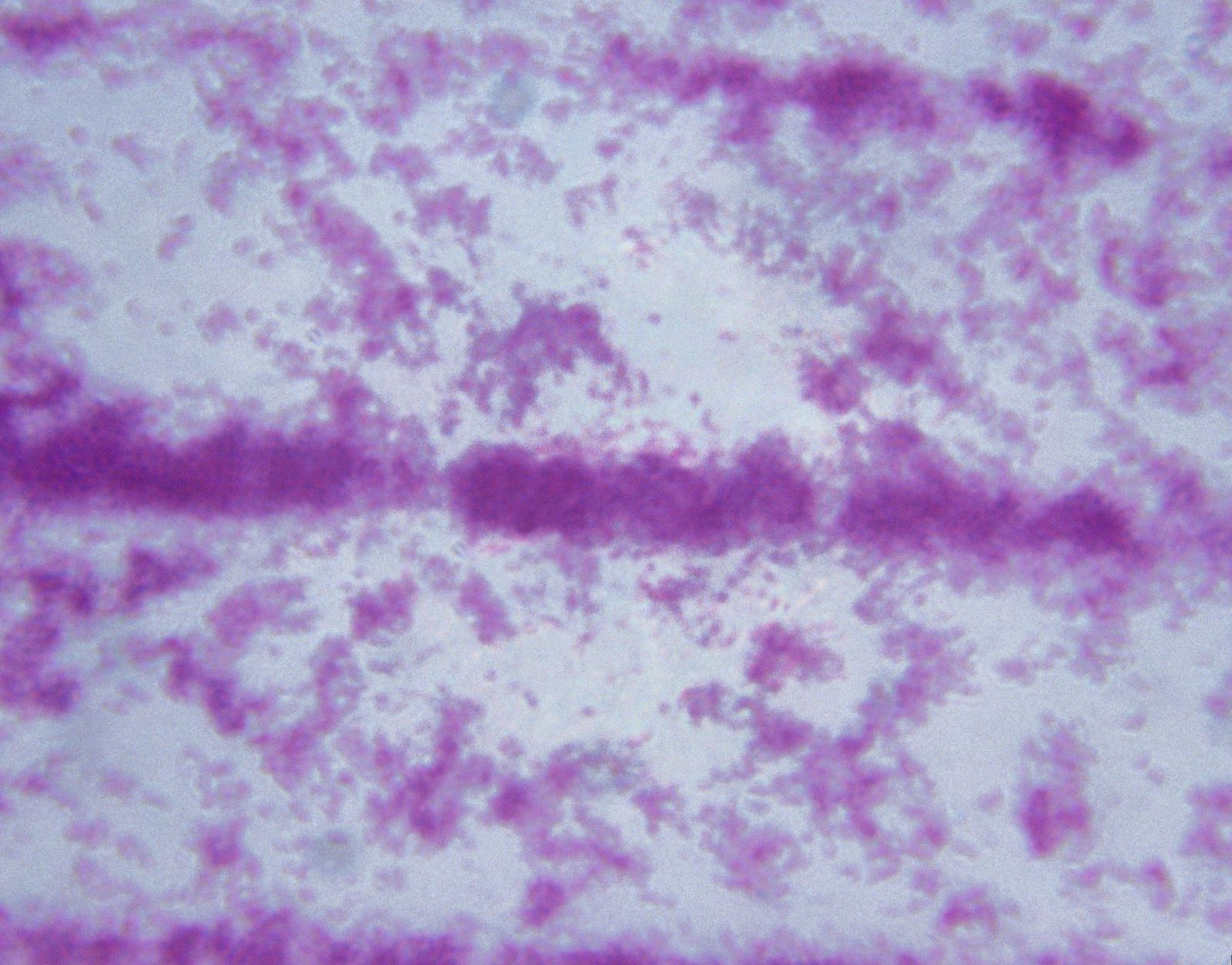 Imagen microscópica de la bacteria de la tuberculosis