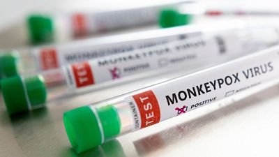 ¿Hasta dónde puede expandirse la viruela del mono? Los expertos descartan una nueva pandemia
