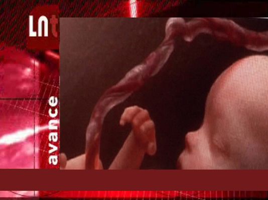 La noche temática - Células madre, una nueva esperanza