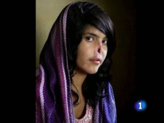 Telediario 1 - World Press Photo