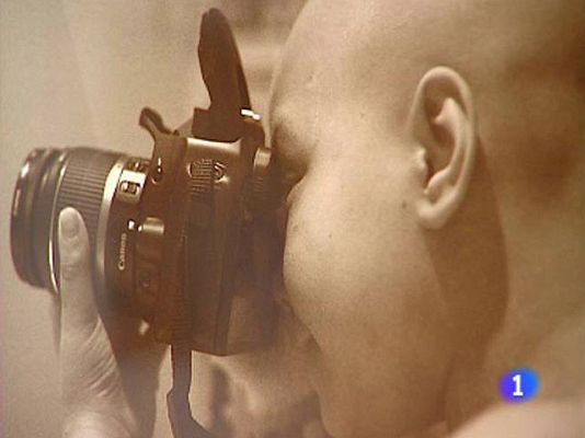 Telediario 1 - Fotogrfías de niños con cáncer