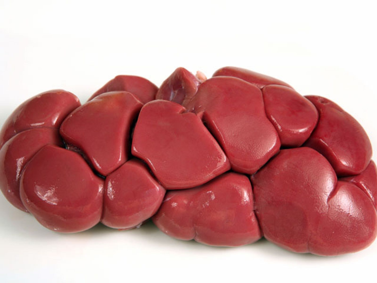 Saber vivir - Riñones con buena salud - 02/03/11