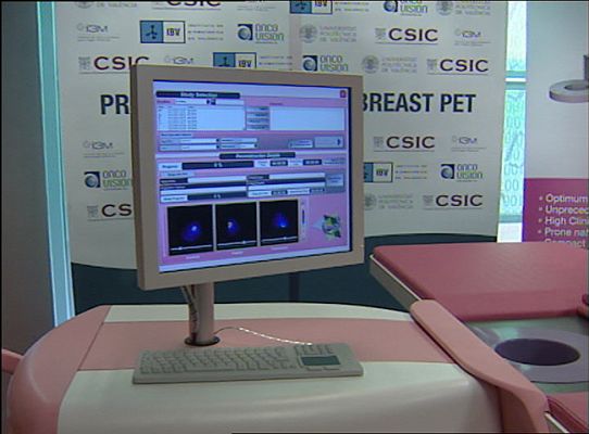 Telediario 1 - Mamógrafo más preciso