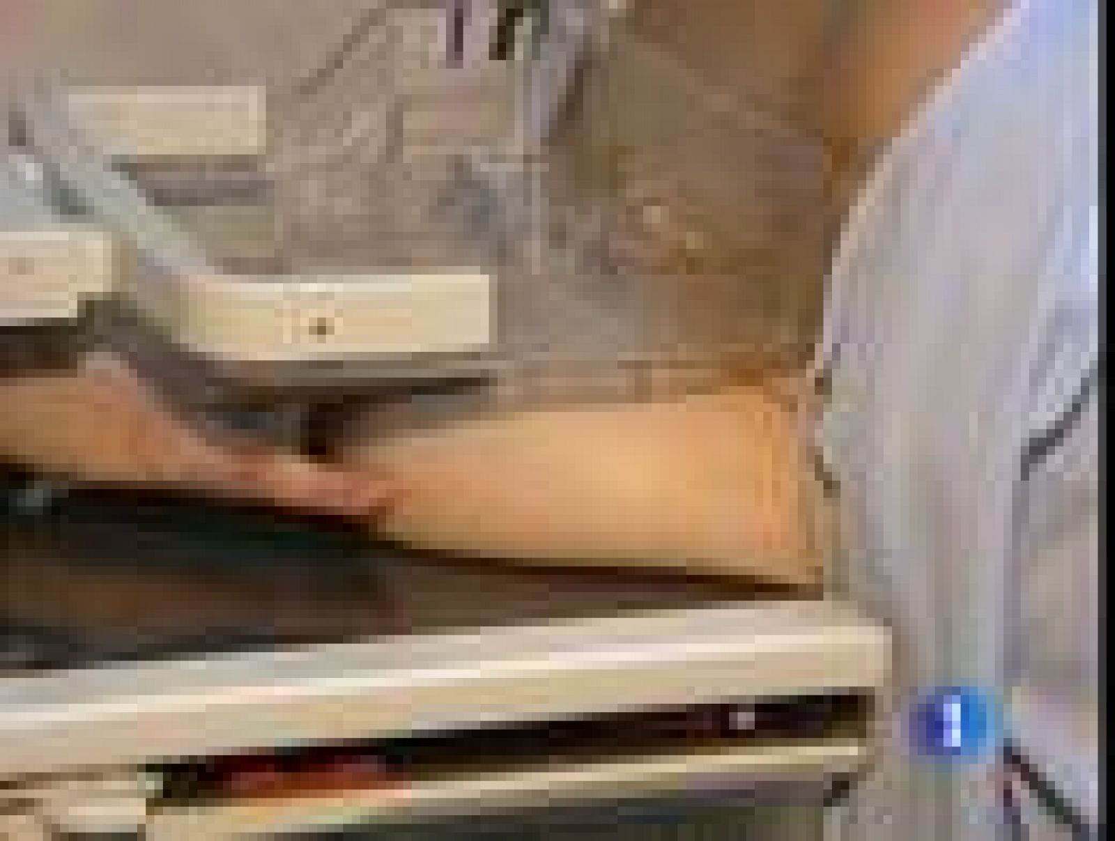 Nuevos equipos médicos que detectan tumores de mama de la cabeza de un alfiler | Ver