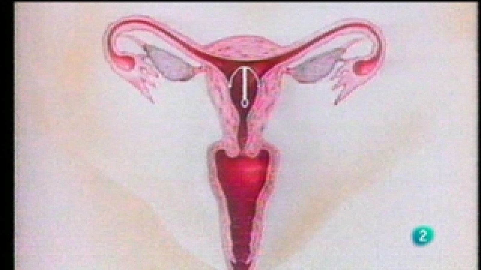 Buenas noticias TV - Los anticonceptivos - Buenas noticias TV | Ver