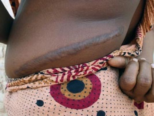 La noche temática - El mercado de los órganos - Avance