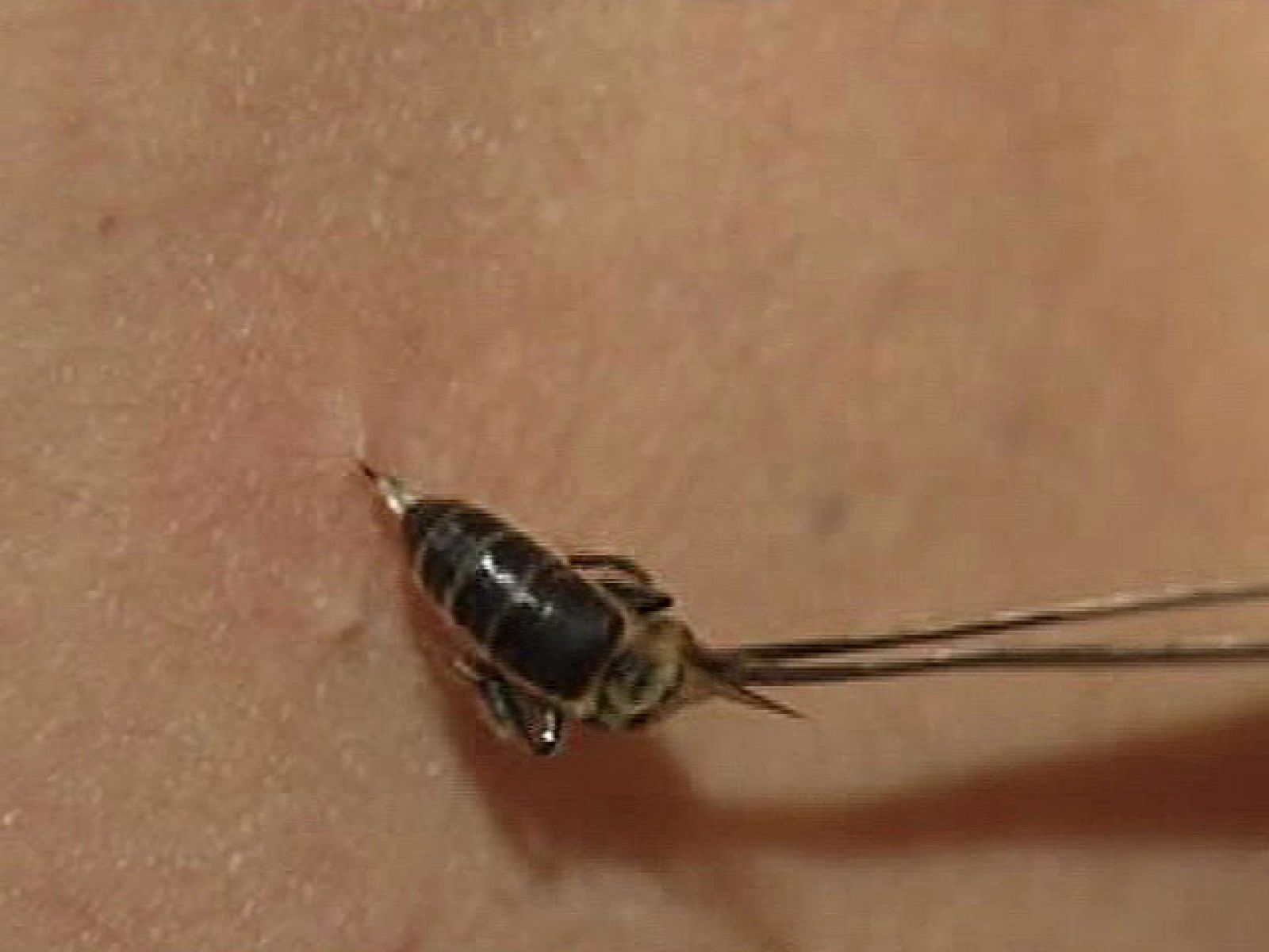 España Directo - Curar con abejas