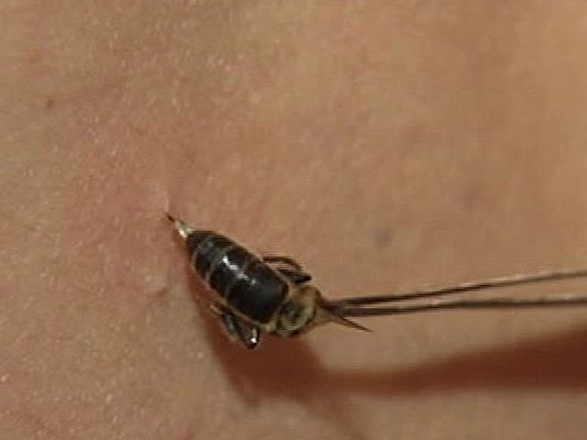 España Directo - Curar con abejas