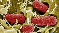 La bacteria E.Coli, responsable de las muertes en Alemania