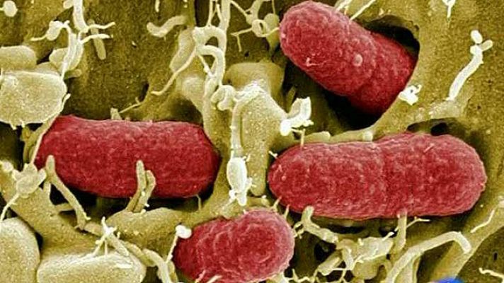 Telediario 1 - El mal de la bacteria E.Coli