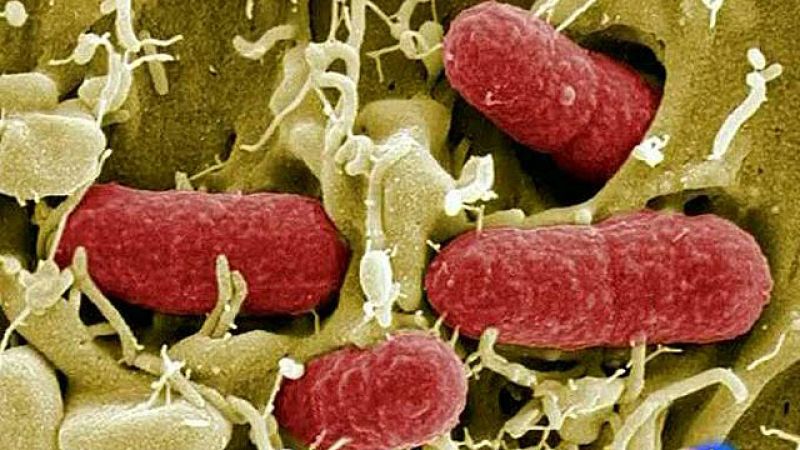  La bacteria E.Coli, responsable de las muertes en Alemania