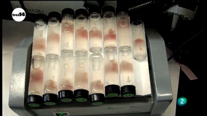 tres14 - Células madre