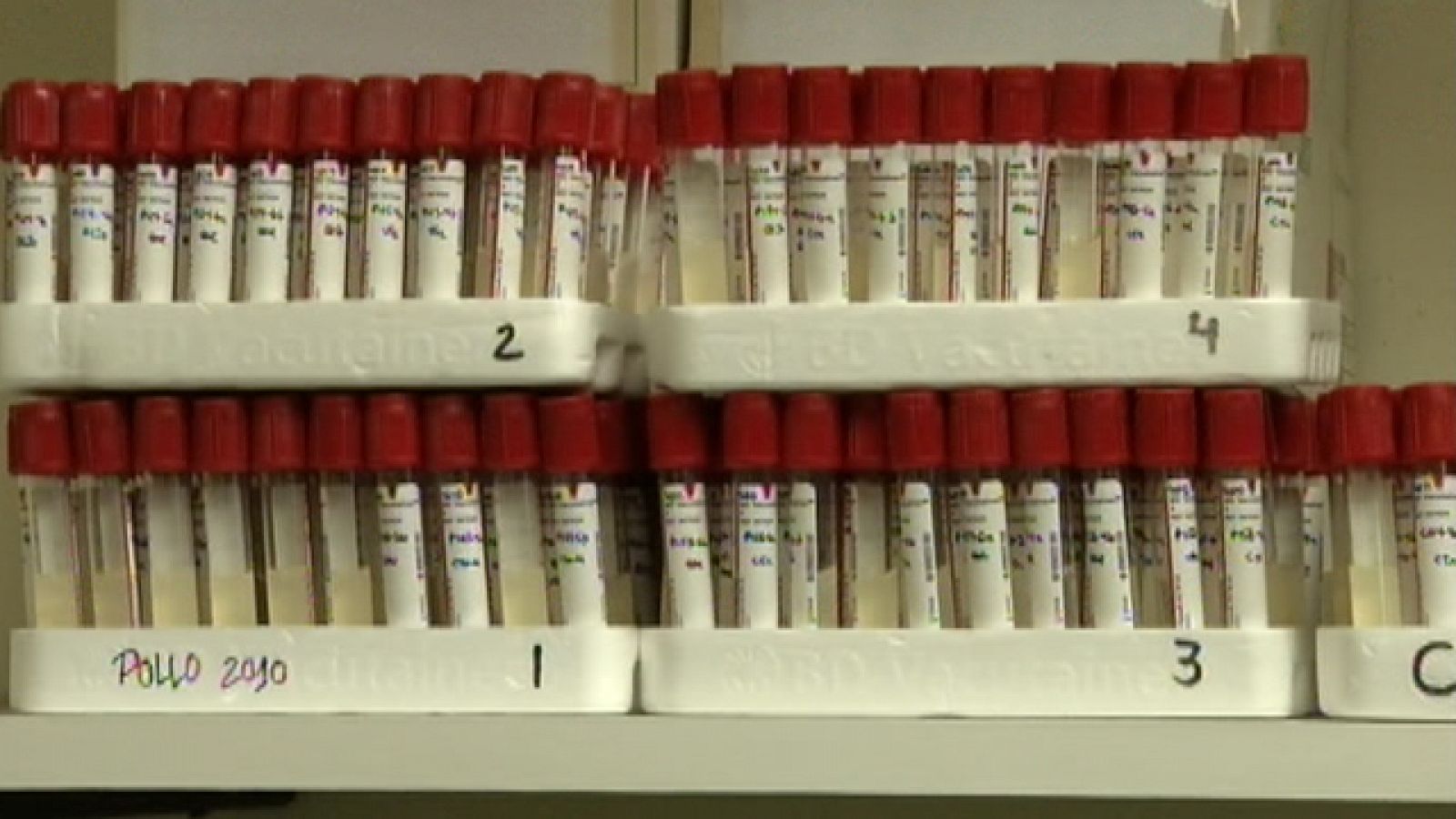 El laboratorio de referencia de la bacteria E. coli se encuentra en Lugo