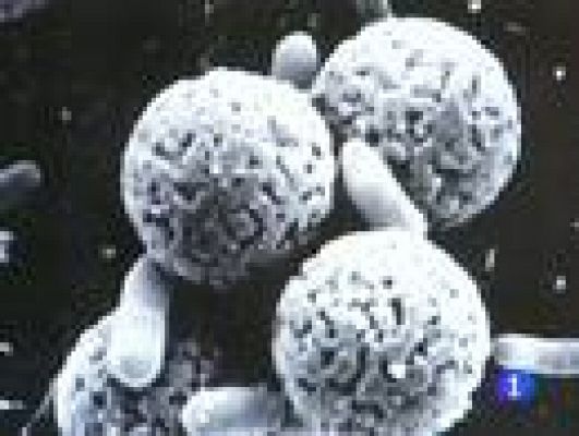 Telediario 1 - El laboratorio de referencia de la bacteria E. coli se encuentra en Lugo