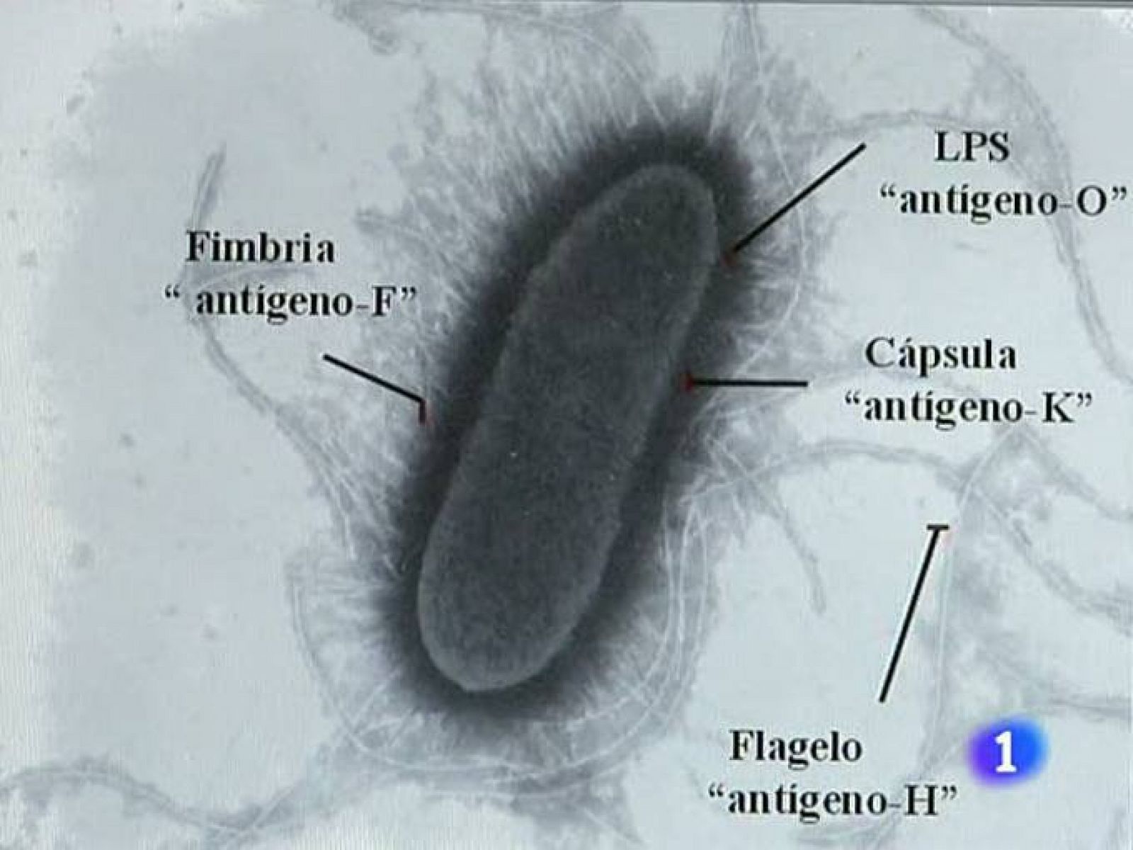 Telediario 1: Laboratorio de la E. coli | RTVE Play