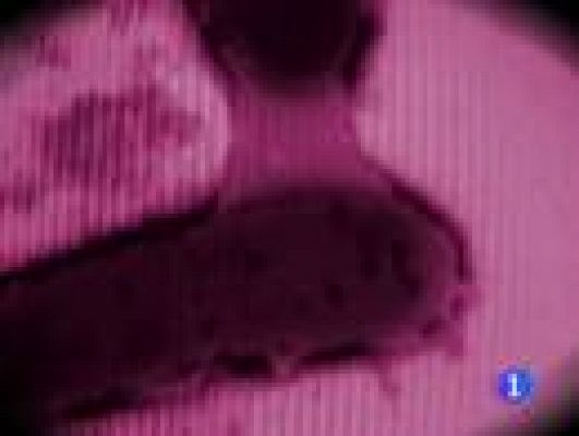 Telediario 1 - El brote de E.coli, por cepa rara