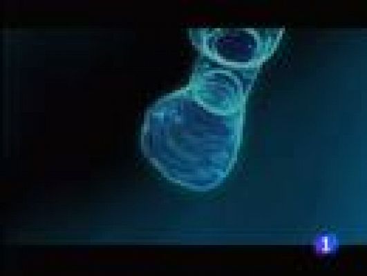 Telediario 1 - Descifran el genoma de la leucemia