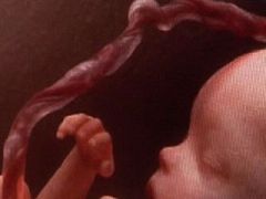 Células madre, un cordón vital. Avance