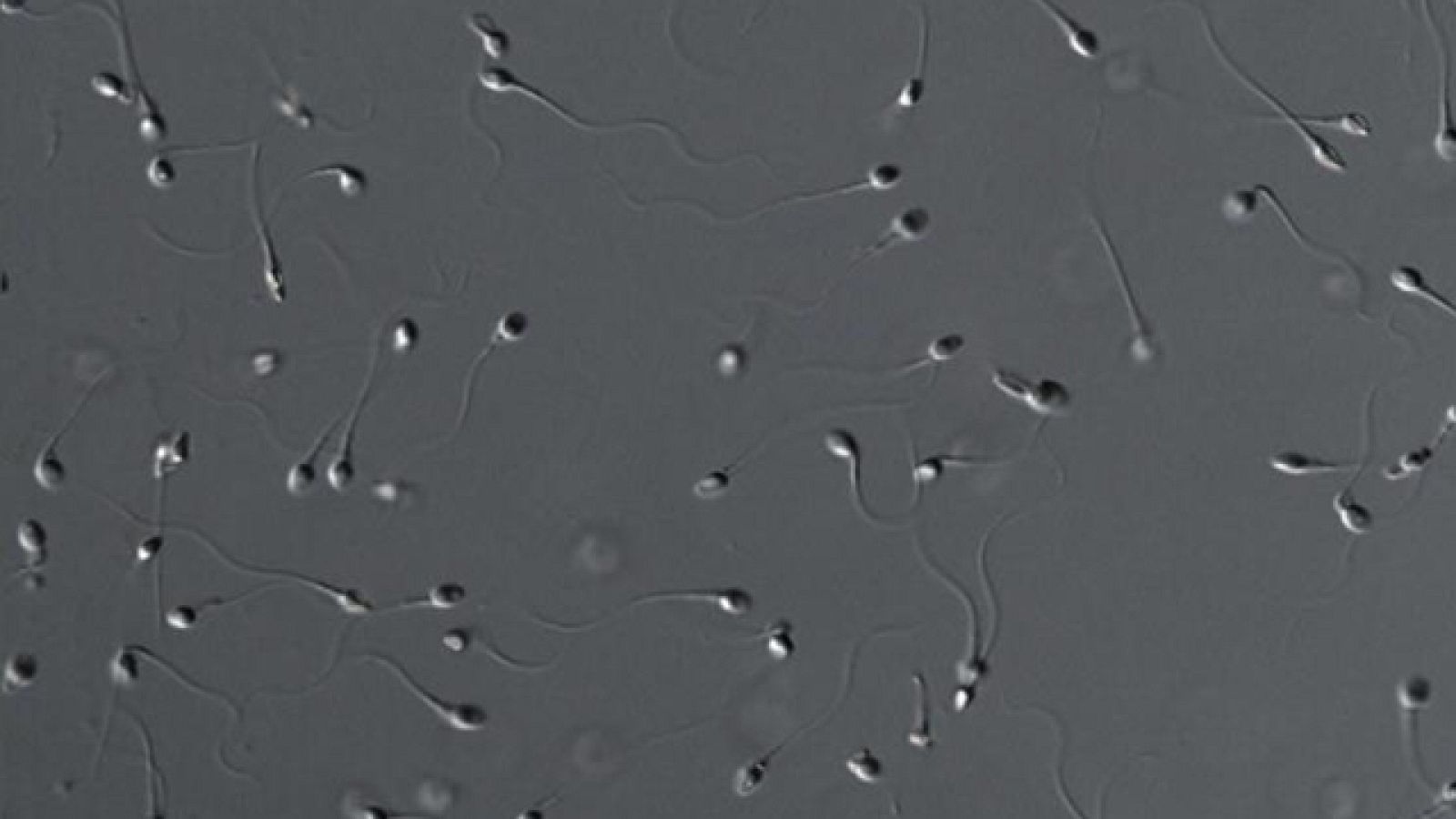 Estudios en torno a la calidad del semen