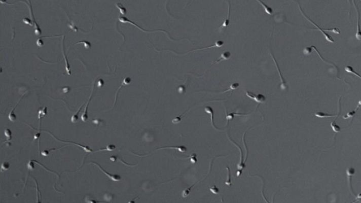 Telediario 1 - Mala calidad del semen