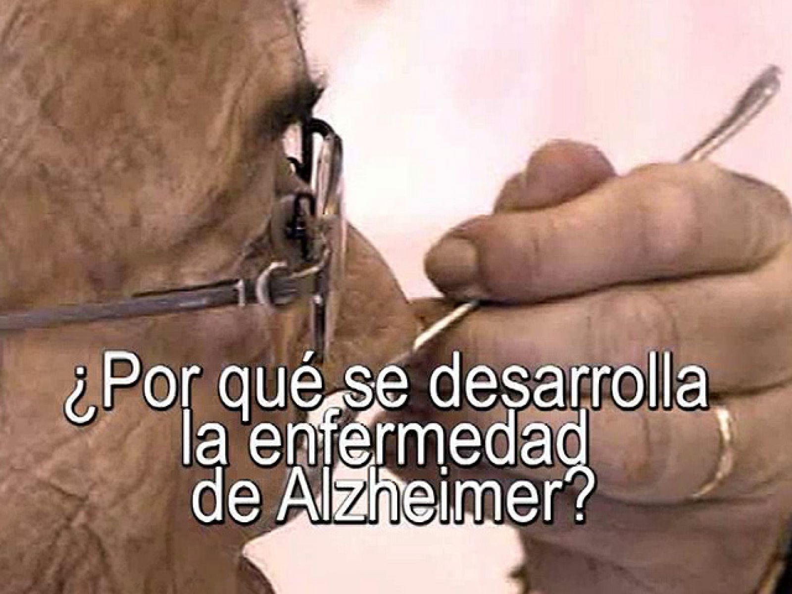 uned - ¿Por qué se desarrolla la enfermedad de Alzheimer? - 15/07/11