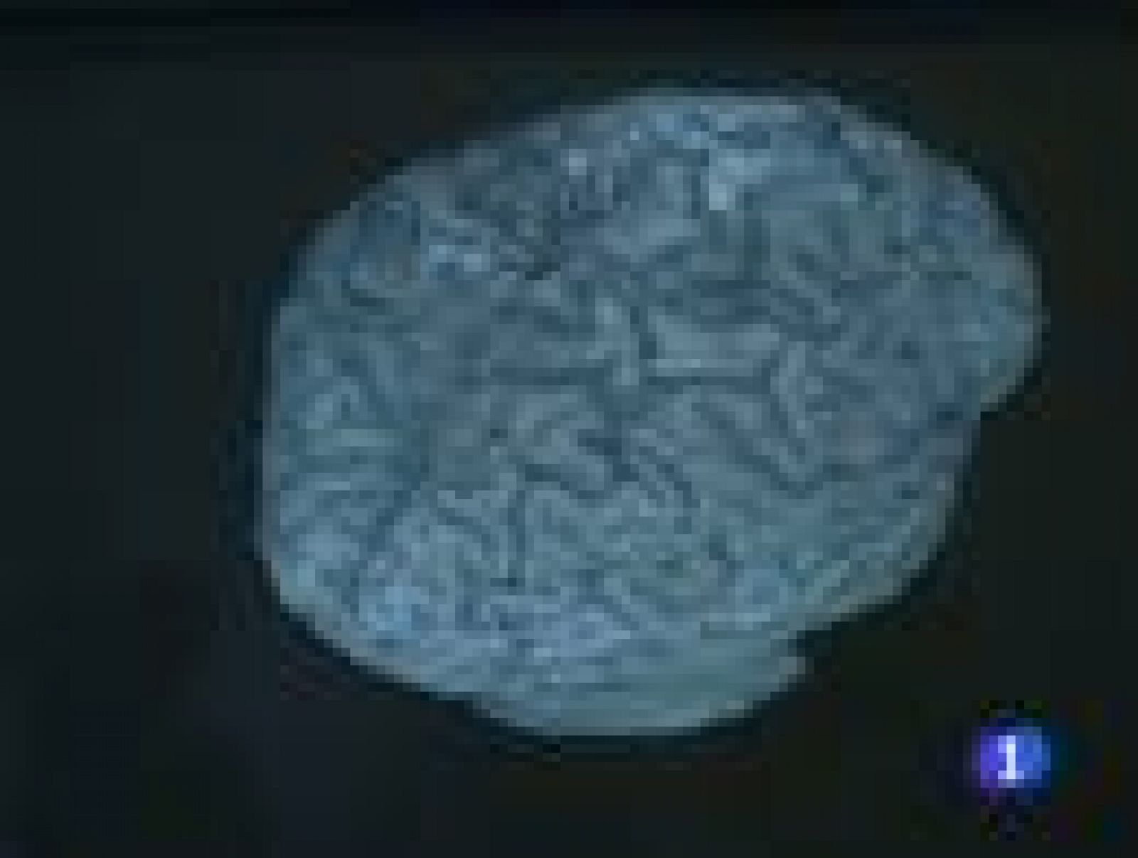 El ictus, primera causa de muerte entre las mujeres y la segunda en los hombres