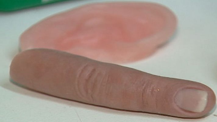 Telediario 1 - La ana-plastología