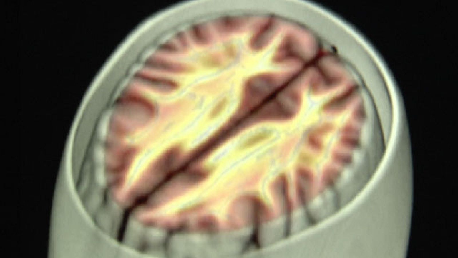 Informe Semanal: La lucha por el recuerdo