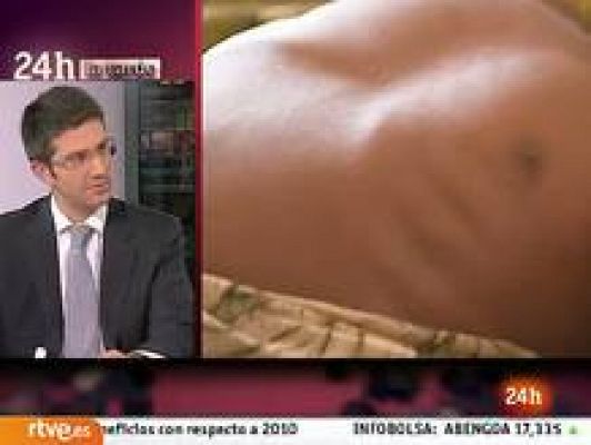 La tarde en 24h - "90 millones en 90 días"