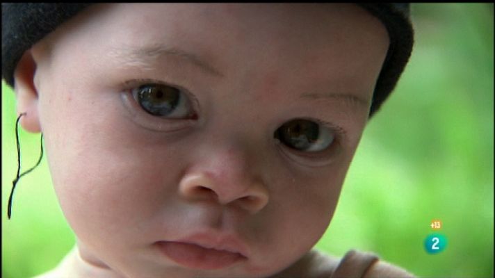 Documentos TV - El club de los albinos