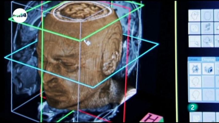 tres14 - Neurolenguaje