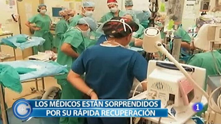 +Gente - Ya no son siamesas