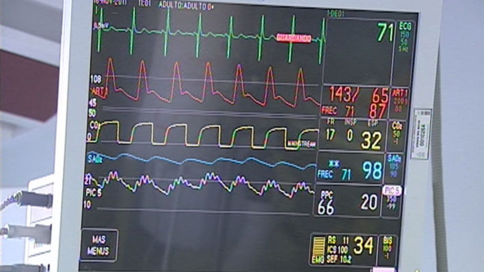 El trabajo dentro de la UCI
