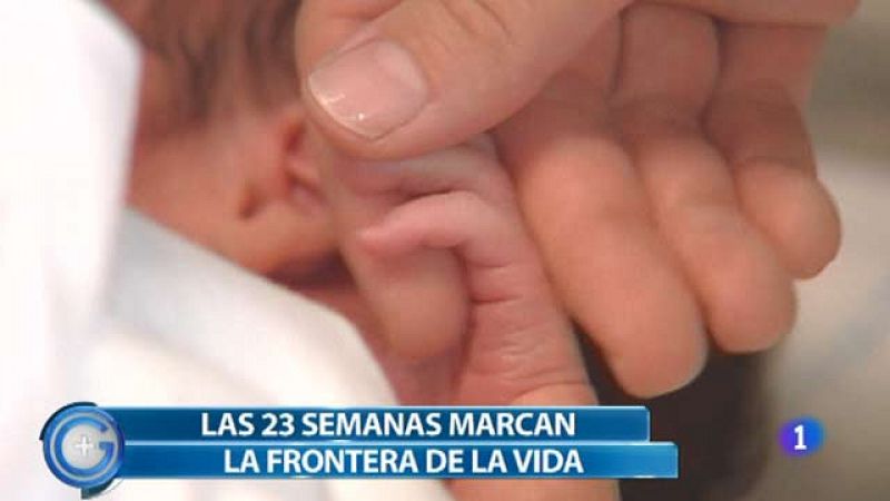 Más Gente - Uno de cada 10 recién nacidos es bebé prematuro