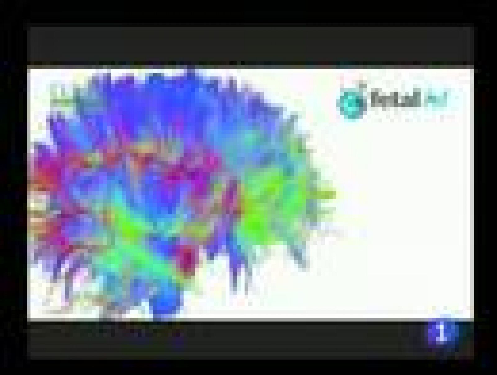 Telediario 1: Imagen de las conexiones neuronales | RTVE Play