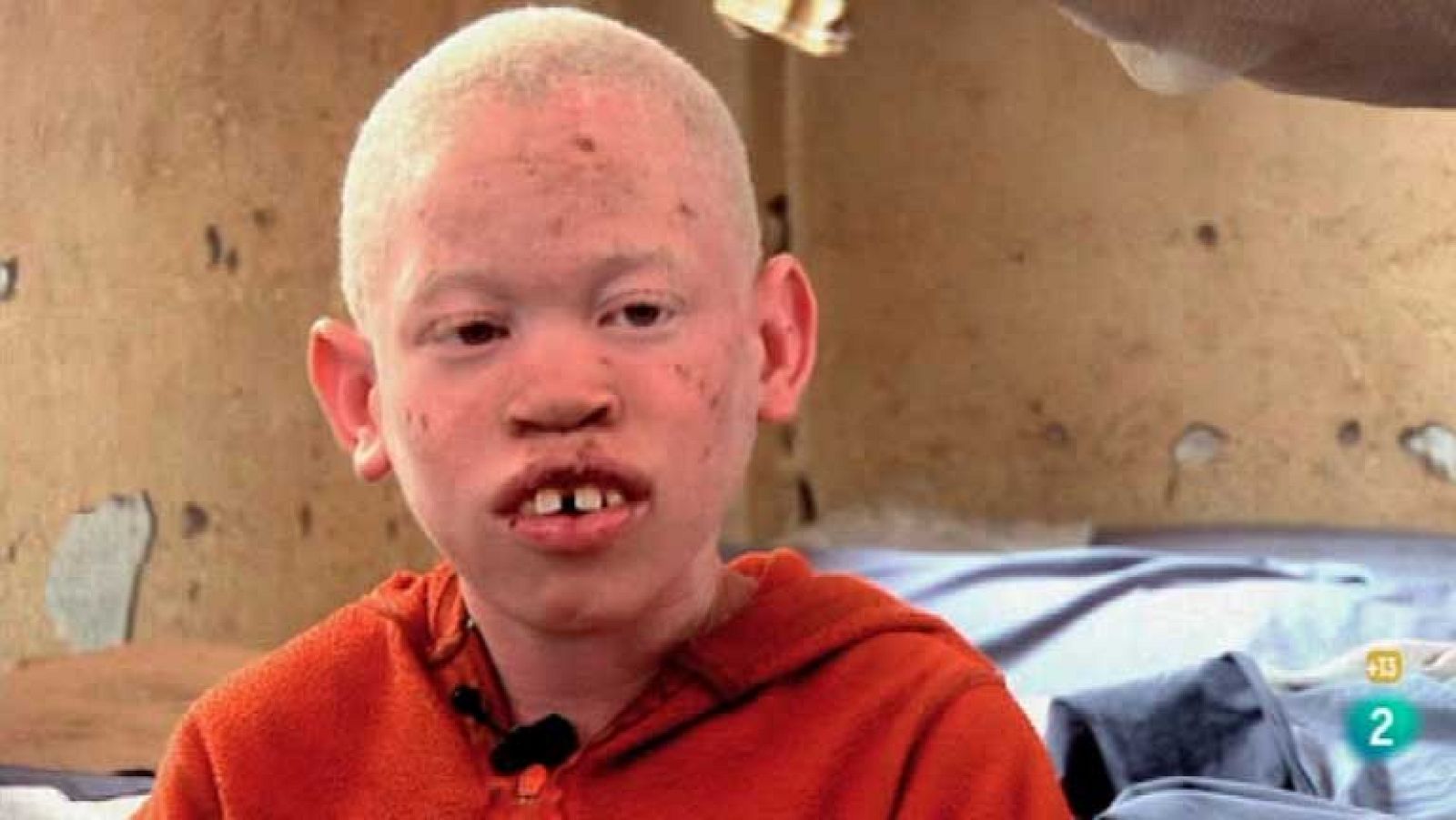 La noche temática - La caza de albinos en África - Ver ahora