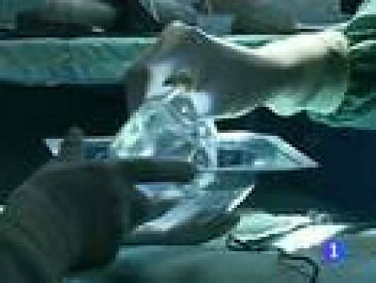 Telediario 1 - Retirada de las prótesis mamarias