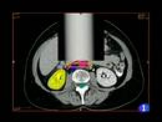 Informativo de Madrid - Informativo de Madrid - 11/01/12