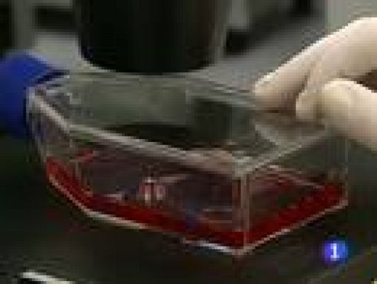 Telediario 1 - Aumento del sarampión