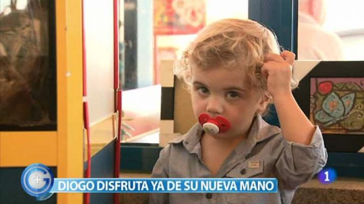 El pequeño Diogo ya tiene dos manos