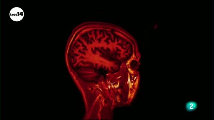 tres14 - Coeficiente intelectual