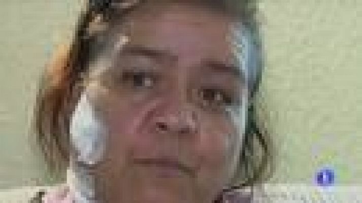 Ataque a la activista Norma Andrade